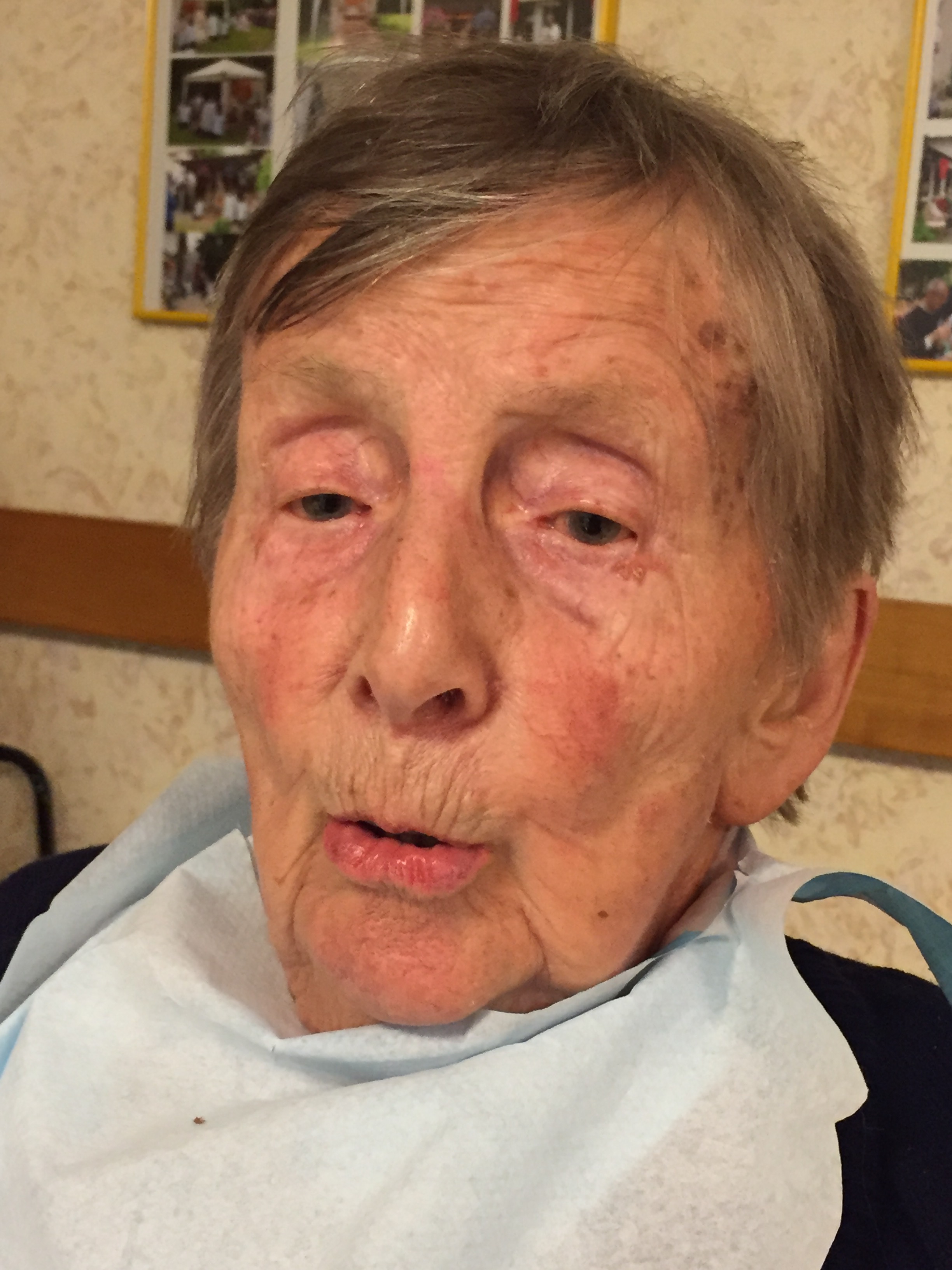 Profil zuerst in den Lippen ...